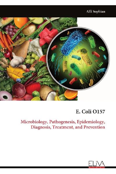 E. Coli O157: Microbiology, Pathogenesis, Epidemiology, Diagnosis, Treatment, and Prevention