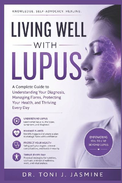 Living Well With Lupus: A Complete Guide To Understanding Your Diagnosis, Managing Flares, Protecting Your Health, And Thriving Every Day
