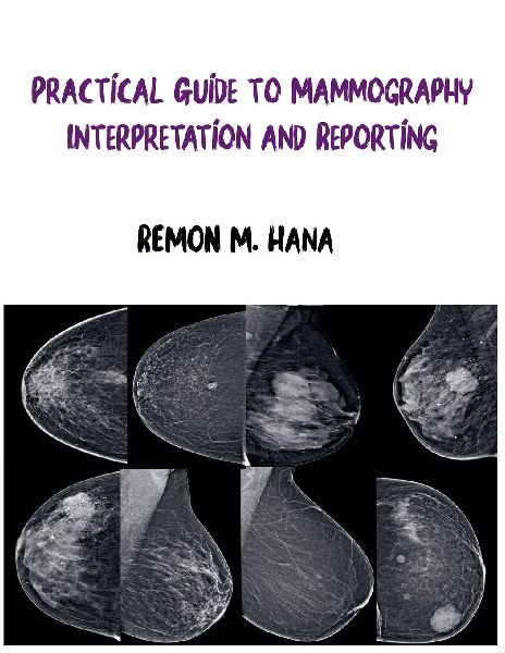 Practical Guide to Mammography Interpretation and Reporting