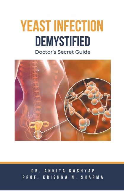 Yeast Infection: Demystified Doctors Secret Guide