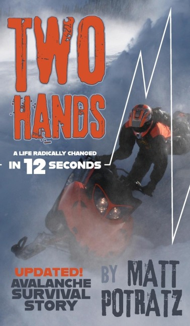 Two Hands: A Life Radically Changed In 12 Seconds