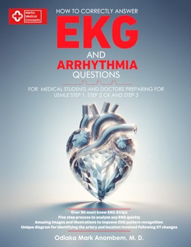How to Correctly Answer EKG and Arrhythmia Questions For Medical Students and Doctors Preparing for USMLE Step 1, Step 2 CK, and Step 3