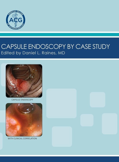 Capsule Endoscopy by Case Study, Volume 2