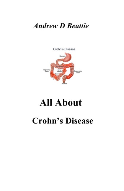 All About Crohns Disease