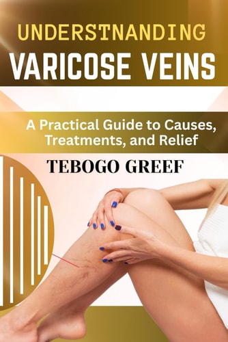 Understnanding Varicose Veins A Practical Guide to Causes, Treatments, and Relief