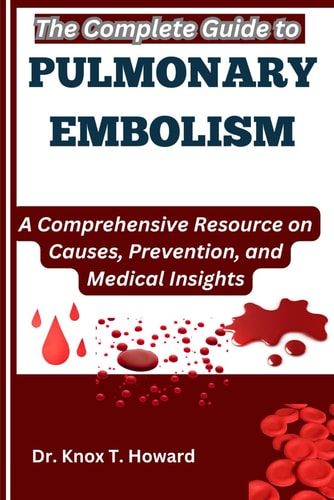 The Complete Guide to Pulmonary Embolism A Comprehensive Resource on Causes, Prevention, and Medical Insights