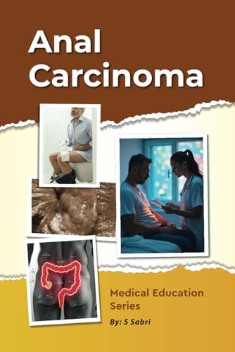 Anal Carcinoma