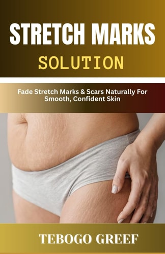 Stretch Marks Solution Fade Stretch Marks & Scars Naturally For Smooth, Confident Skin