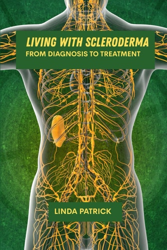 Living with Scleroderma From Diagnosis to Treatment