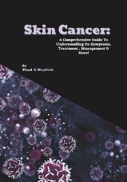 Skin Cancer: A Comprehensive Guide To Understanding Its Symptoms, Treatment , Management & More!