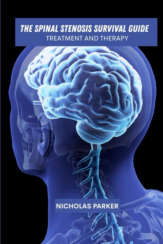 The Spinal Stenosis Survival Guide Treatment and Therapy