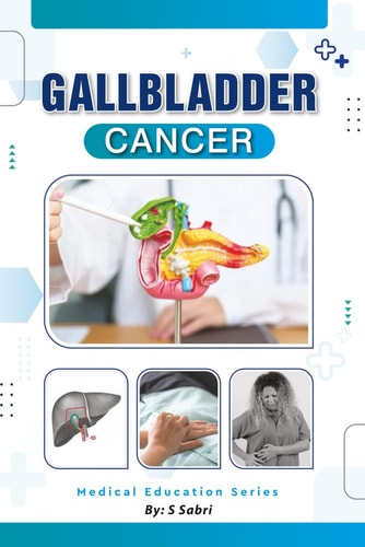 Gall Bladder Cancer