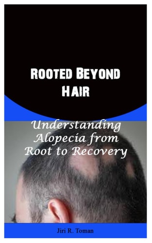 Rooted Beyond Hair Understanding Alopecia from Root to Recovery