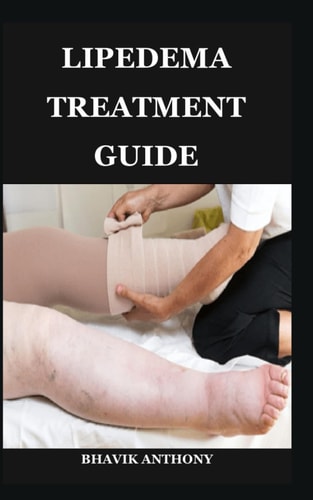 Lipedema Treatment Guide Advanced Treatment Protocols, Compression Strategies, Functional Fitness, and Lifestyle Adjustments for Sustainable Wellness