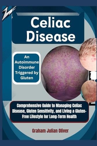 Celiac Disease An Autoimmune Disorder Triggered by Gluten: Comprehensive Guide to Managing Celiac Disease, Gluten Sensitivity, and Living a Gluten-Free Lifestyle for Long-Term Health