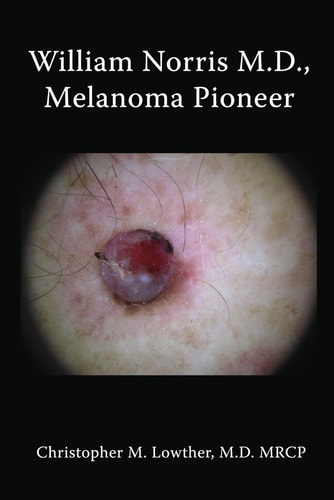 William Norris M.D., Melanoma Pioneer