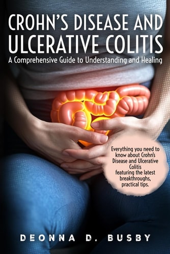 Crohn's Disease and Ulcerative Colitis A Comprehensive Guide to Understanding and Healing Empowering Tools for Living Well with IBD - Your Roadmap to Informed Treatment and Lasting Wellness