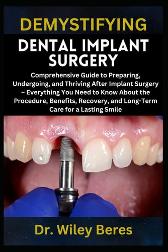 Demystifying Dental Implant Surgery Comprehensive Guide to Preparing, Undergoing, and Thriving After Implant Surgery - Everything You Need to Know About the Procedure, Benefits, Recovery, and Long-Term Care for a Lasting Smile