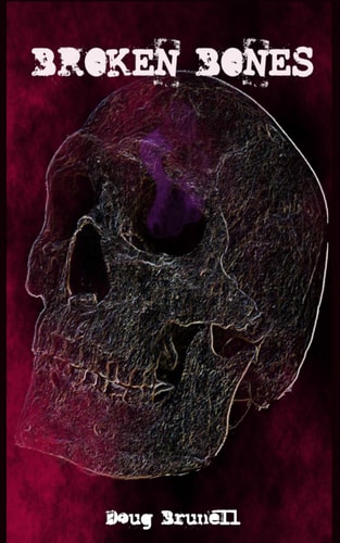 Broken Bones
