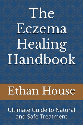 The Eczema Healing Handbook Ultimate Guide to Natural and Safe Treatment