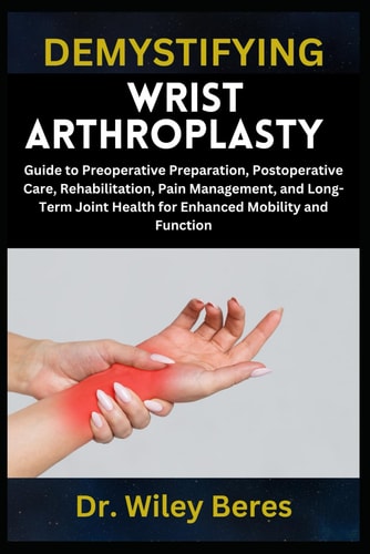 Demystifying Wrist Arthroplasty Guide to Preoperative Preparation, Postoperative Care, Rehabilitation, Pain Management, and Long-Term Joint Health for Enhanced Mobility and Function