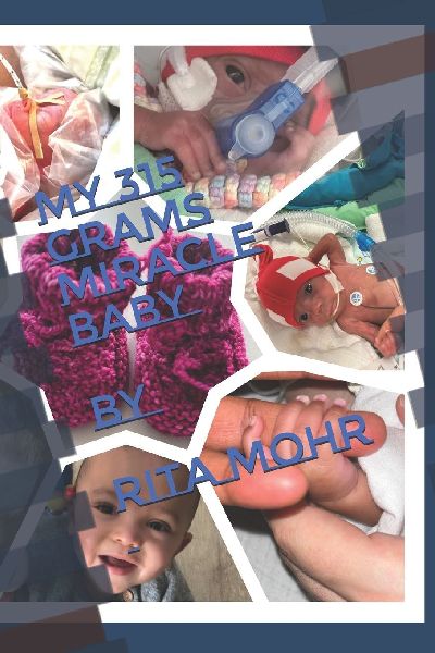 My 315 Grams Miracle Baby: Tiny but Mighty, A Premature babys fight for life