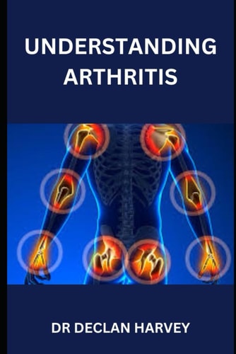 Understanding Arthritis