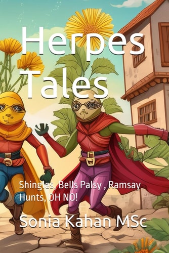 Herpes Tales Shingles, Bells Palsy, Ramsay Hunts, OH NO!