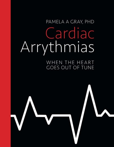Cardiac Arrythmias When the Heart Goes Out of Tune