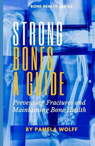 Strong Bones A Guide Preventing Fractures and Maintaining Bone Health