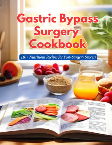 Gastric Bypass Surgery Cookbook 110+ Nutritious Recipes for Post-Surgery Success