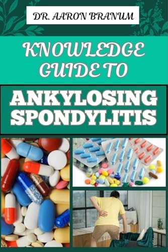 Knowledge Guide to Ankylosing Spondylitis Comprehensive Manual To Diagnosis, Treatment, Pain Management, And Lifestyle Tips For Improved Mobility And Quality Of Life