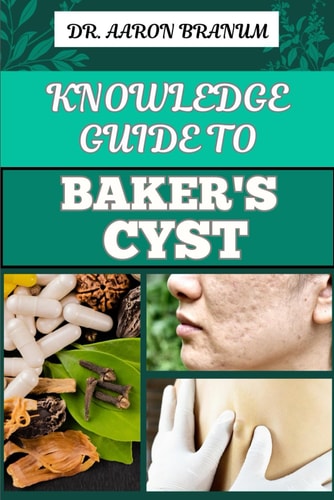 Knowledge Guide to Baker's Cyst Essential Manual To Symptoms, Diagnosis, Treatment Options, And Prevention For Optimal Knee Health