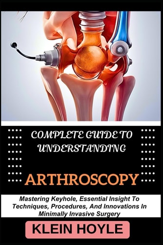 Complete Guide to Understanding Arthroscopy Mastering Keyhole, Essential Insight To Techniques, Procedures, And Innovations In Minimally Invasive Surgery