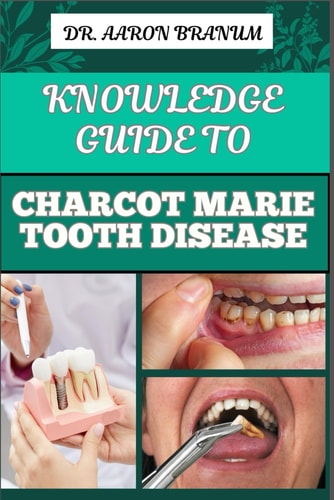 Knowledge Guide to Chacot Marie Tooth Disease Essential Manual To Symptoms, Treatment Options, Genetic Causes, And Coping Strategies