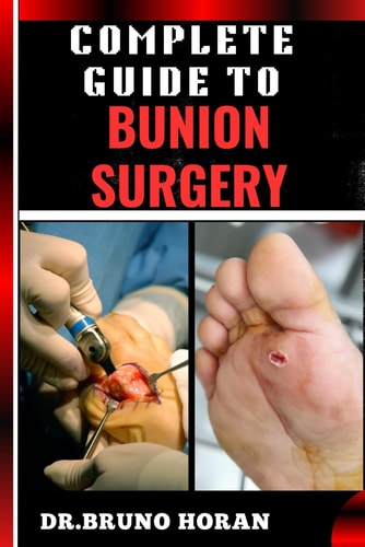 Complete Guide to Bunion Surgery Essential Handbook For Expert Techniques, Recovery Tips, And Pain Management For Optimal Foot Health