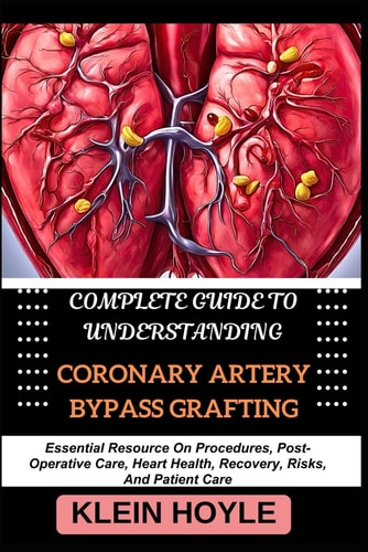 Complete Guide to Understanding Coronary Artery Bypass Grafting Essential Resource On Procedures, Post-Operative Care, Heart Health, Recovery, Risks, And Patient Care