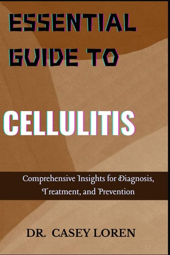 Essential Guide to Cellulitis Comprehensive Insights for Diagnosis, Treatment, and Prevention