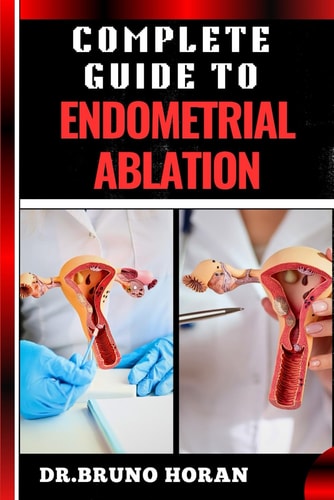 Complete Guide to Endometrial Ablation Essential Manual To Minimally Invasive Treatment For Heavy Menstrual Bleeding, Uterine Health, And Long Term Relief