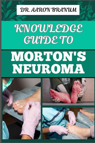Knowledge Guide to Morton's Neuroma Essential Manual To Symptoms, Diagnosis, Treatment, And Pain Relief For Foot Health And Nerve Pain Management