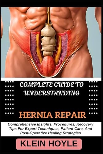 Complete Guide to Understanding Hernia Repair Comprehensive Insights, Procedures, Recovery Tips For Expert Techniques, Patient Care, And Post-Operative Healing Strategies
