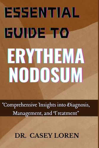 Essential Guide to Erythema Nodosum Comprehensive Insights Into Diagnosis, Management, and Treatment