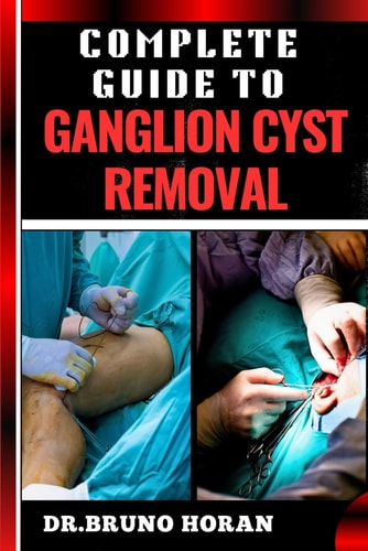 Complete Guide to Ganglion Cyst Removal Comprehensive Handbook To Expert Techniques, Home Remedies, And Post Surgery Care For Pain Relief And Healing