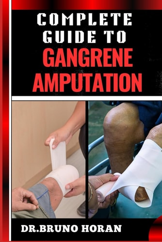 Complete Guide to Gangrene Amputation Comprehensive Handbook To Diagnosis, Prevention, Treatment, And Recovery Strategies For Optimal Health Outcomes