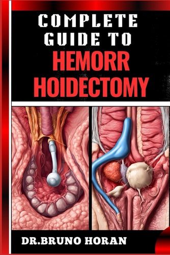 Complete Guide to Hemorrhoidectomy Comprehensive Handbook To Surgical Treatment, Recovery, Pain Management, And Post Operative Care