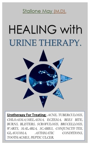HEALING with URINE THERAPY. Urotherapy For Treating; ACNE, TUBERCULOSIS, CHLOASMA/MELASMA, ECZEMA, BEES BITE, BURNS, BLISTERS, SCROFULOSIS, BRUCELLOSIS, WARTS, MALARIA, SCABIES, CONJUNCTIVITIS, GLAU