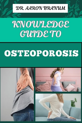Knowledge Guide to Osteoporosis Essential Manual To Prevention, Diagnosis, And Treatment Strategies For Stronger And Improved Bone Health