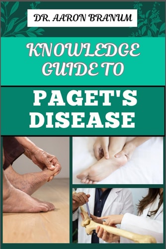 Knowledge Guide to Paget's Disease Essential Manual To Symptoms, Diagnosis, Treatment Options, and Long-term Management