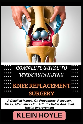 Complete Guide to Understanding Knee Replacement Surgery A Detailed Manual On Procedures, Recovery, Risks, Alternatives For Arthritis Relief And Joint Health Improvement