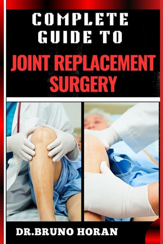 Complete Guide to Joint Replacement Surgery Comprehensive Handbook To Recovery, Benefits, Risks, And Rehabilitation For Hip, Knee, And Shoulder Procedures